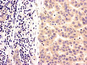 GA黄金甲(中国游)最新官方网站