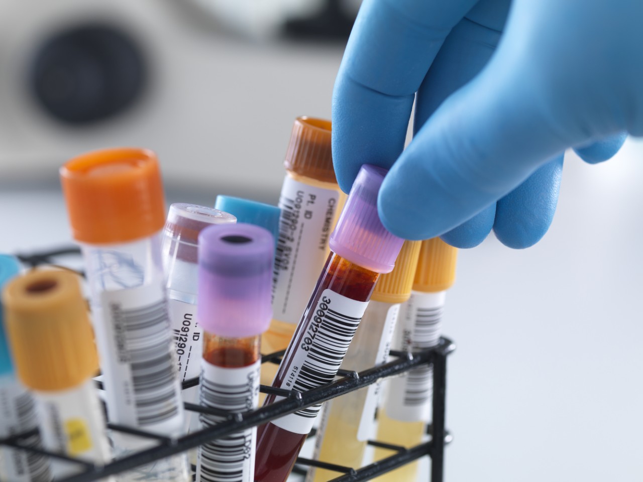 一致性评价大幕开启，，，医院市场即将调解