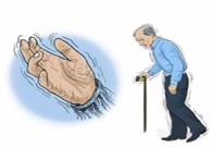 帕金森病，，，，“帕”不怕？？？？？