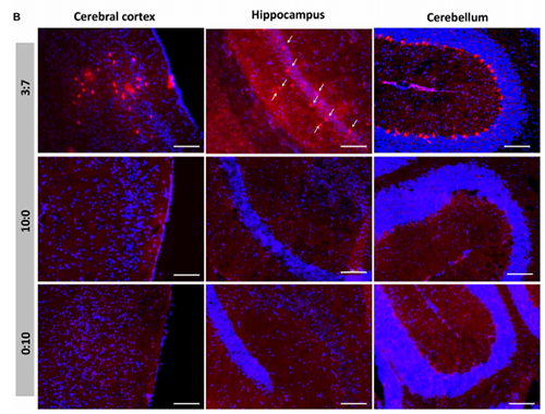 被包裹在含有NT-类脂质的LNP中的Cre重组酶乐成转移。。。。。。大脑中的转染神经元呈红色高亮。。。。。。