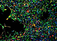 天下首创：药物将干细胞指导至受损部位，，，，，提高其愈合能力！
