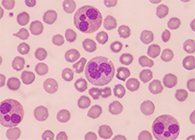 一种神秘颗粒被发明了！它能否成为败血症早筛标记物？？？？