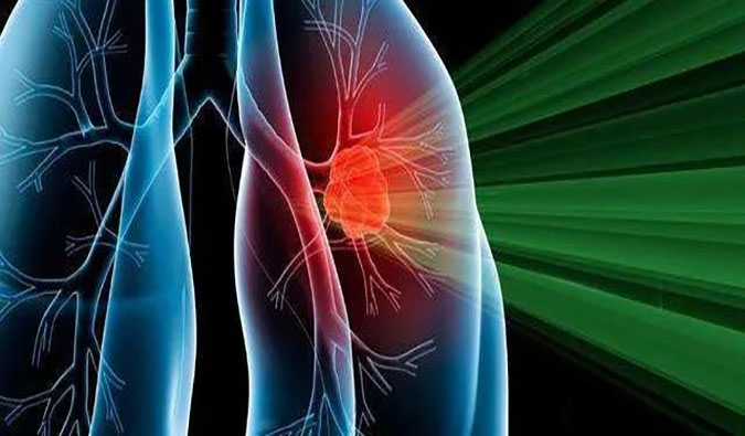 盛世泰科1类立异药物CGT-9475实现中美双报双批 | GA黄金甲一站式临床宿世物医药研发效劳平台助力