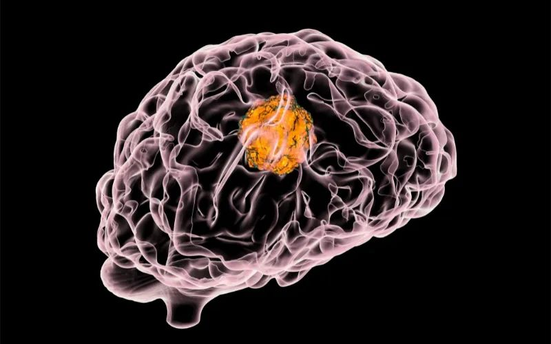 GA黄金甲助力 | 璧辰医药ABM-1310获美国FDA孤儿药资格认证，，，，用于治疗携带BRAF V600突变的脑胶质母细胞瘤患者