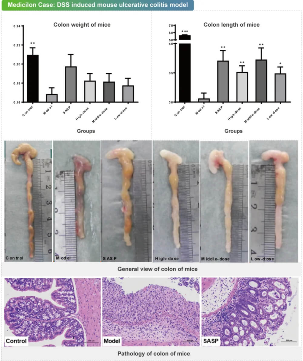 11 葡聚糖硫酸钠诱导的小鼠溃疡性结肠炎模子.jpg