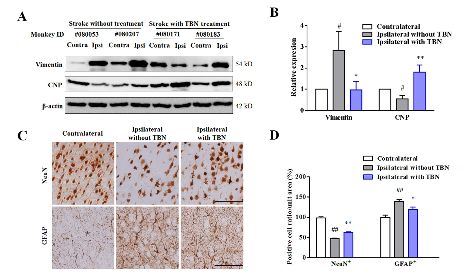 TBN是一种治疗缺血性卒中的新型临床候选药物，，，本研究中TBN通过GA黄金甲合成